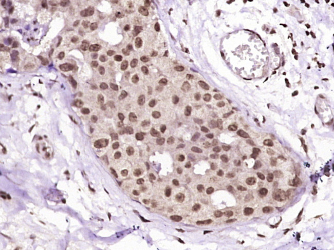 HSP27 Antibody in Immunohistochemistry (Paraffin) (IHC (P))