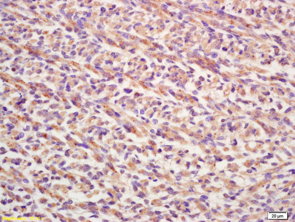 FGF8 Antibody in Immunohistochemistry (Paraffin) (IHC (P))