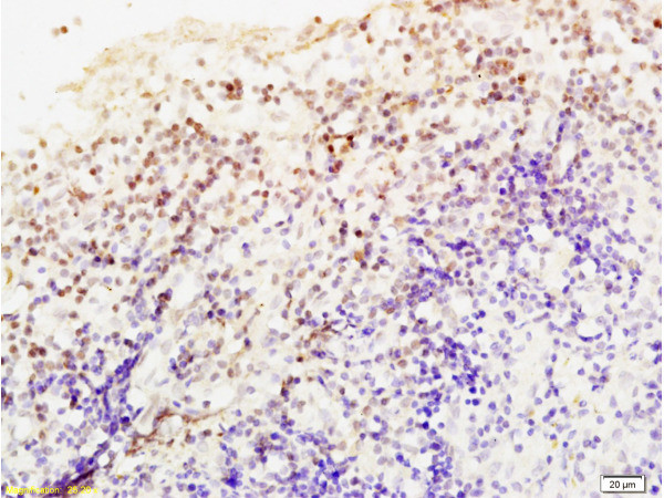 Livin Antibody in Immunohistochemistry (Paraffin) (IHC (P))