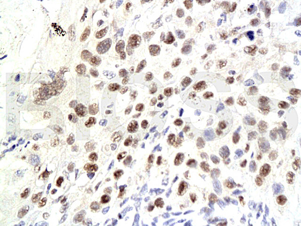 CDKN1A Antibody in Immunohistochemistry (Paraffin) (IHC (P))