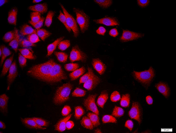 CDKN1B Antibody in Immunocytochemistry (ICC/IF)