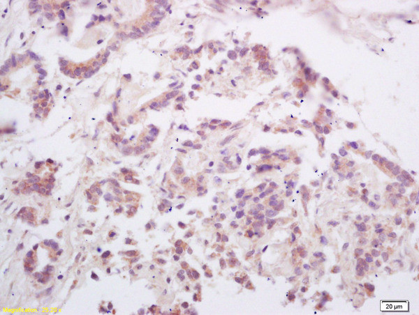 RANKL Antibody in Immunohistochemistry (Paraffin) (IHC (P))