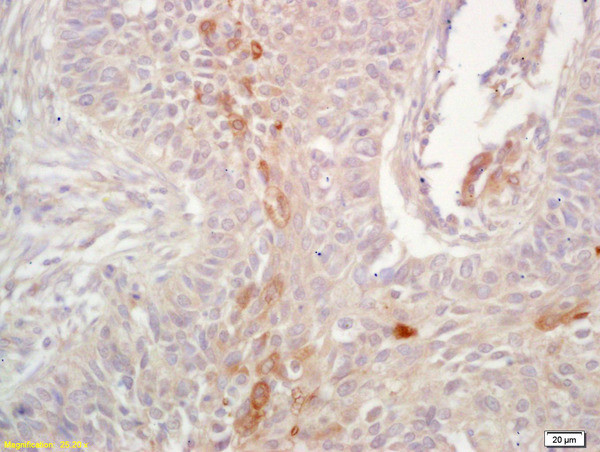HLA G Antibody in Immunohistochemistry (Paraffin) (IHC (P))