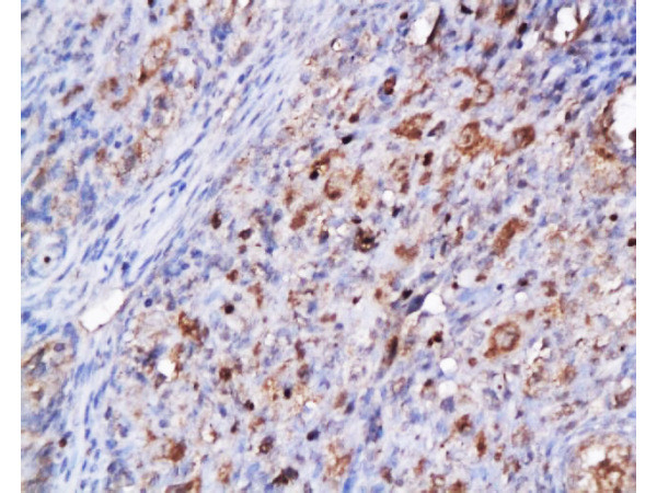 CDK2 Antibody in Immunohistochemistry (Paraffin) (IHC (P))