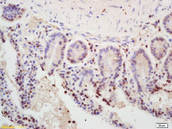MSH2 Antibody in Immunohistochemistry (Paraffin) (IHC (P))