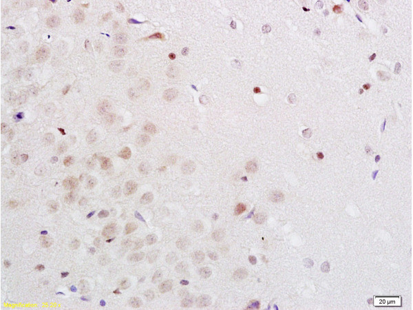 Midnolin Antibody in Immunohistochemistry (Paraffin) (IHC (P))