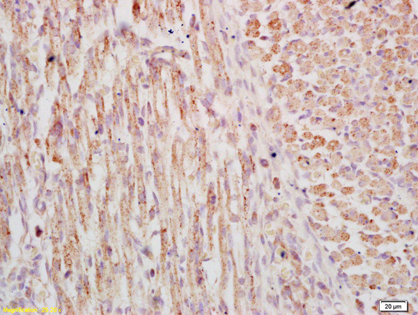 Phospho-FSCN1 (Ser39) Antibody in Immunohistochemistry (Paraffin) (IHC (P))