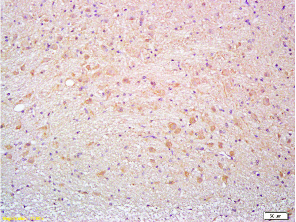 Thy1 Antibody in Immunohistochemistry (Paraffin) (IHC (P))