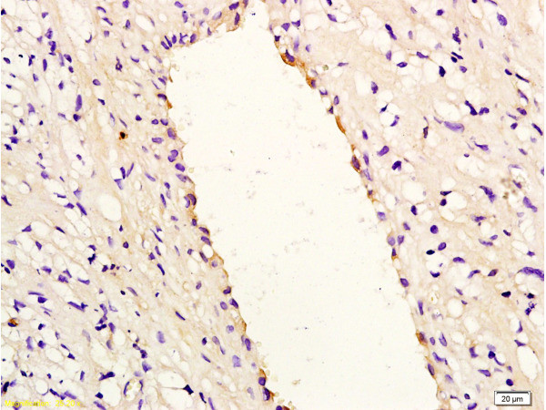IL-8 Antibody in Immunohistochemistry (Paraffin) (IHC (P))
