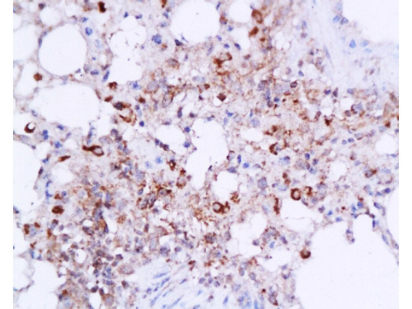IL-6 Antibody in Immunohistochemistry (Paraffin) (IHC (P))