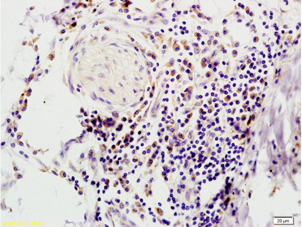 FABP2 Antibody in Immunohistochemistry (Paraffin) (IHC (P))