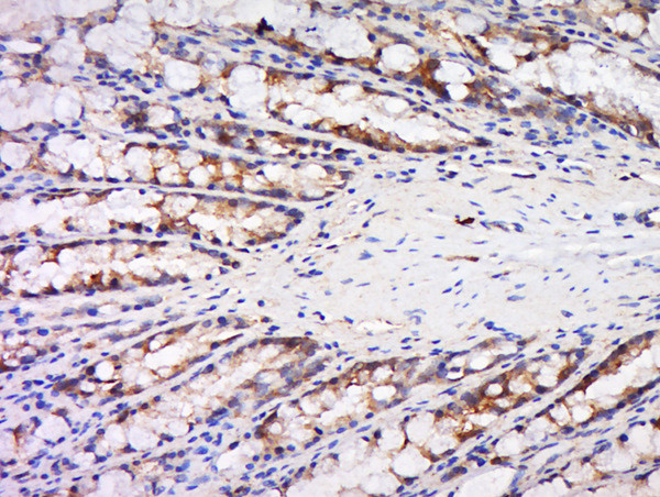 Maspin Antibody in Immunohistochemistry (Paraffin) (IHC (P))
