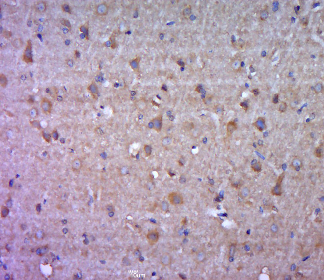 Fascin1 Antibody in Immunohistochemistry (Paraffin) (IHC (P))