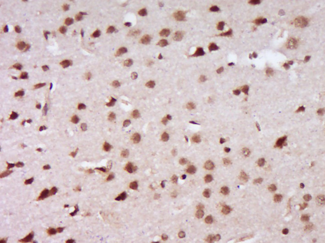 BRCA1 Antibody in Immunohistochemistry (Paraffin) (IHC (P))