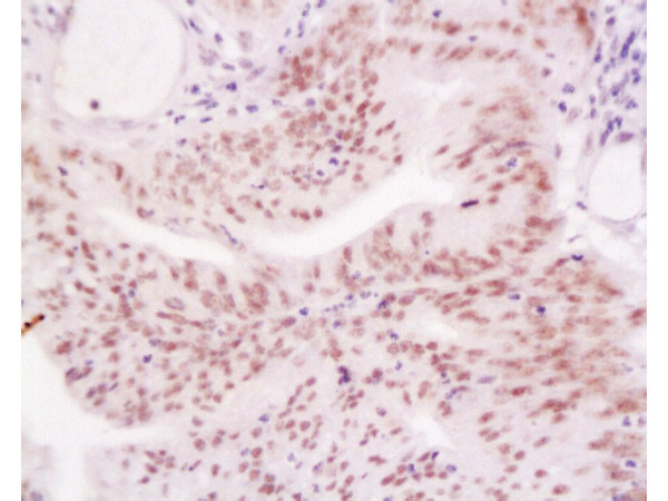 MLH1 Antibody in Immunohistochemistry (Paraffin) (IHC (P))
