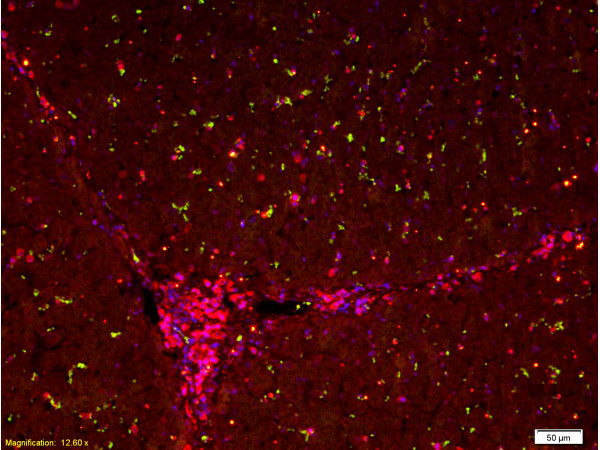 GFP Antibody in Multiplex Immunohistochemistry (mIHC)