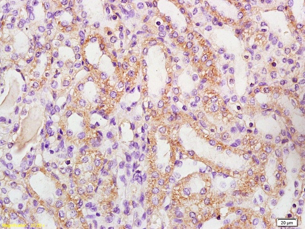 Phospho-BAD (Ser128) Antibody in Immunohistochemistry (Paraffin) (IHC (P))