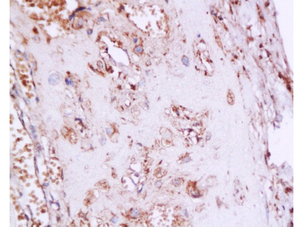 Phospho-ESR1 (Ser167) Antibody in Immunohistochemistry (Paraffin) (IHC (P))