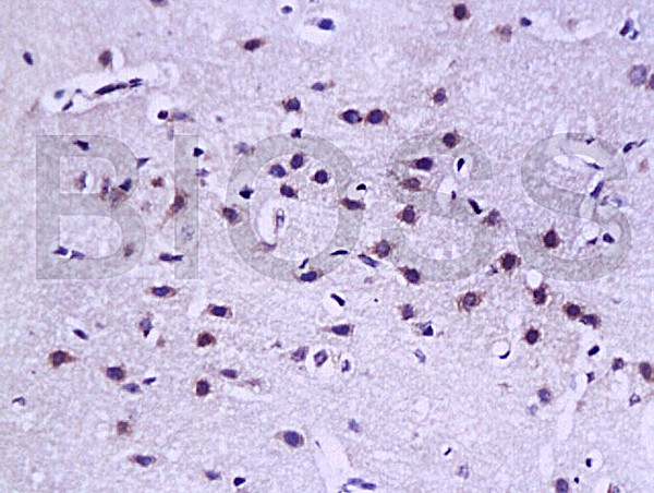 LAMR1CT Antibody in Immunohistochemistry (Paraffin) (IHC (P))