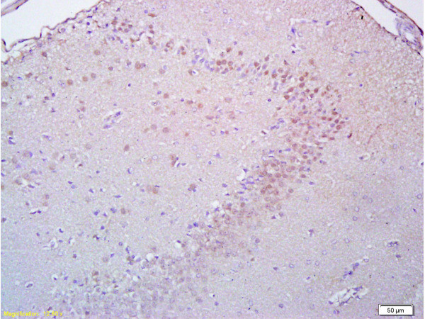 BrdU Antibody in Immunohistochemistry (Paraffin) (IHC (P))