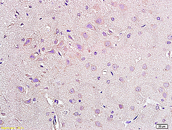 NPY2R Antibody in Immunohistochemistry (Paraffin) (IHC (P))