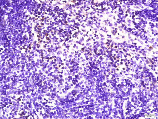 NKG2D Antibody in Immunohistochemistry (Paraffin) (IHC (P))