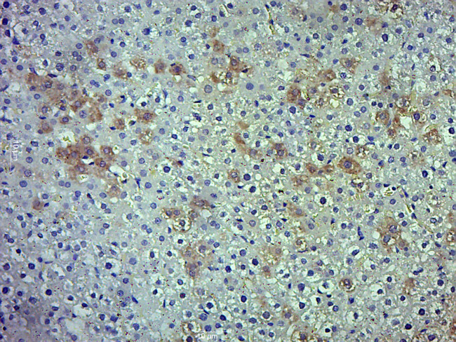 ADRB2 Antibody in Immunohistochemistry (Paraffin) (IHC (P))