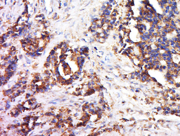 Collagen 3 Antibody in Immunohistochemistry (Paraffin) (IHC (P))