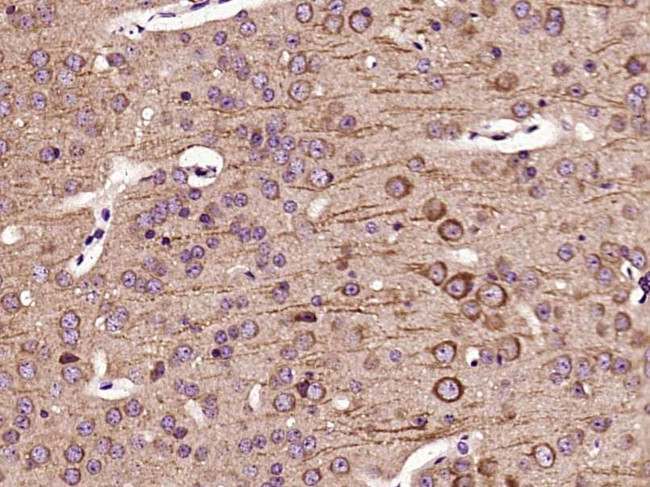 Leptin receptor Antibody in Immunohistochemistry (Paraffin) (IHC (P))