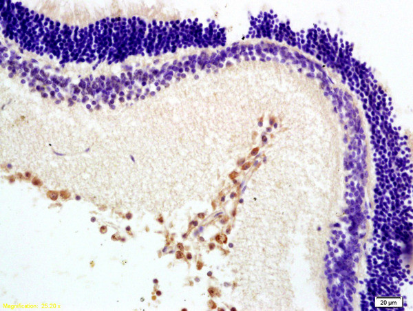 MTNR1B Antibody in Immunohistochemistry (Paraffin) (IHC (P))