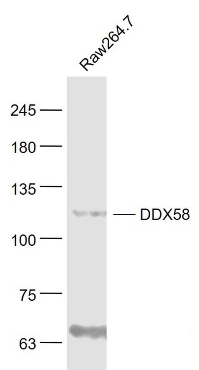 DDX58 Antibody in Western Blot (WB)