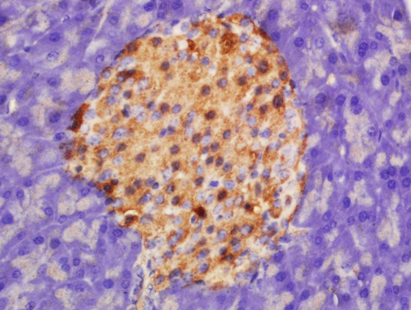HADHSC Antibody in Immunohistochemistry (Paraffin) (IHC (P))