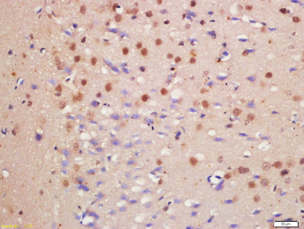 HDAC3/HD3 Antibody in Immunohistochemistry (Paraffin) (IHC (P))