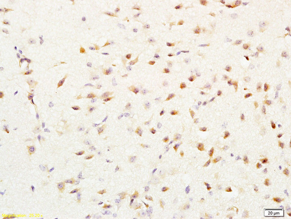 MGMT Antibody in Immunohistochemistry (Paraffin) (IHC (P))
