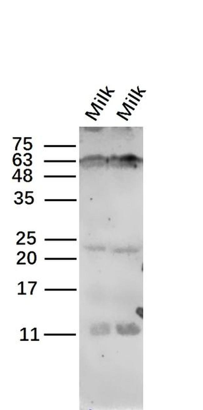 CSN3 Antibody in Western Blot (WB)