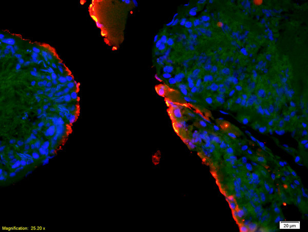 EPHA10 Antibody in Immunohistochemistry (Paraffin) (IHC (P))