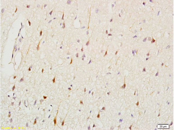 CK2 Antibody in Immunohistochemistry (Paraffin) (IHC (P))