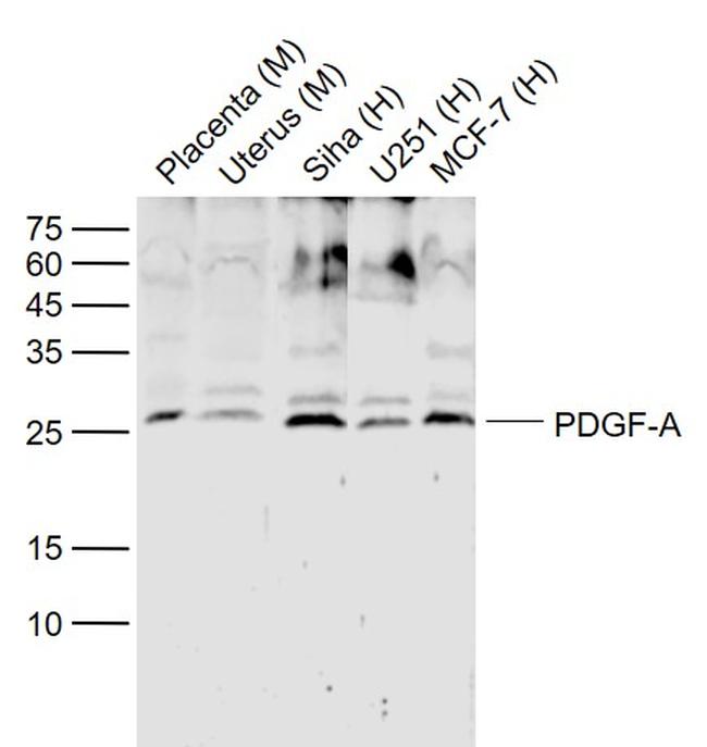 PDGF A Antibody in Western Blot (WB)