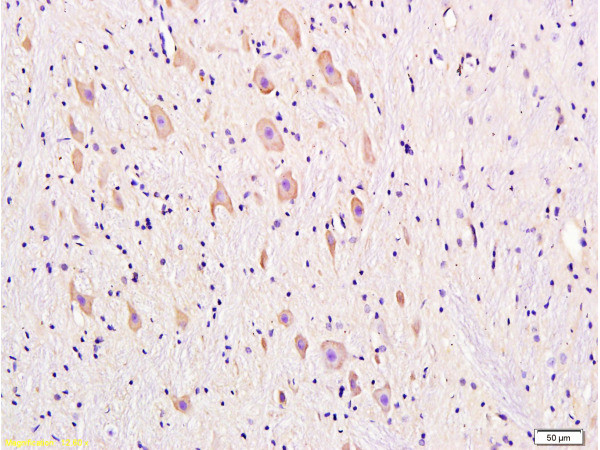 DRD1 Antibody in Immunohistochemistry (Paraffin) (IHC (P))