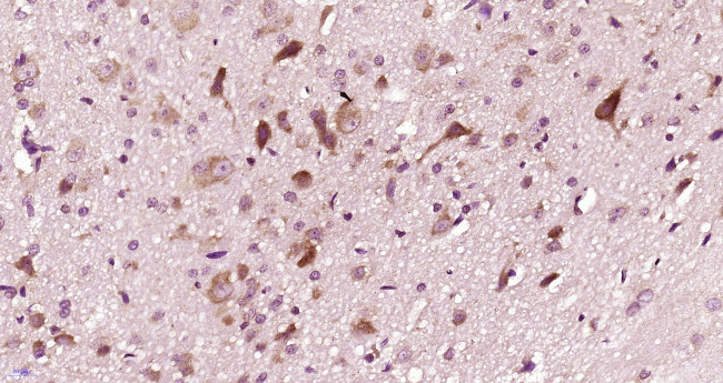 DRD2 Antibody in Immunohistochemistry (Paraffin) (IHC (P))