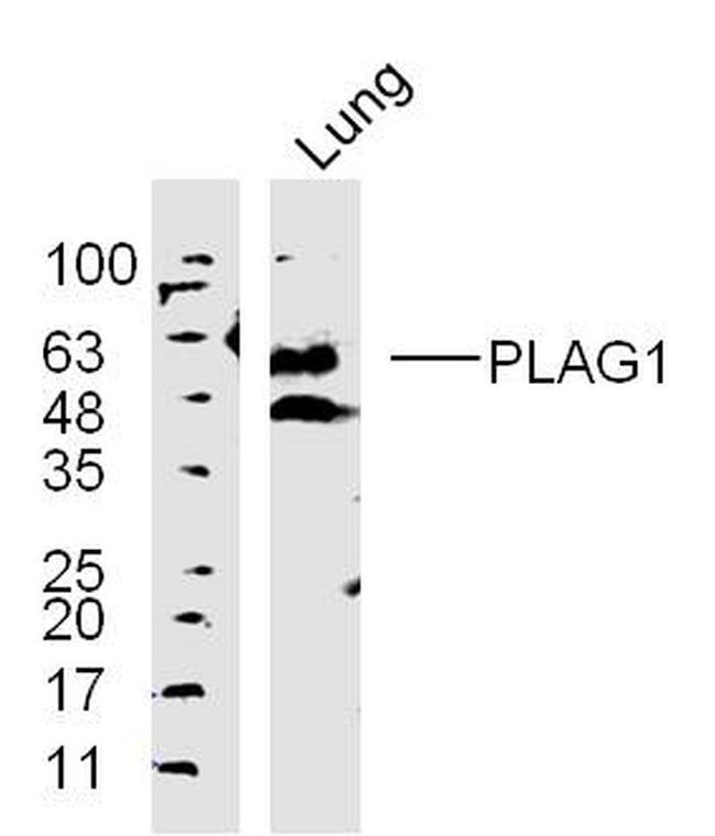 PLAG1 Antibody in Western Blot (WB)