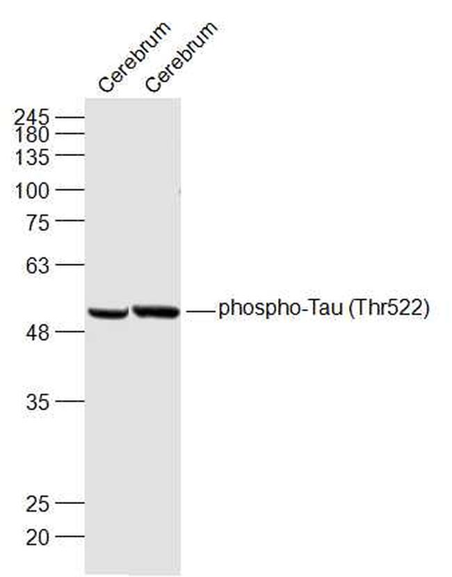 Phospho-Tau protein (Thr522) Antibody in Western Blot (WB)