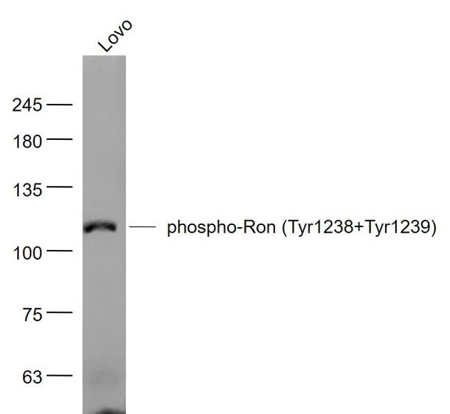 Phospho-Ron (Tyr1238, Tyr1239) Antibody in Western Blot (WB)