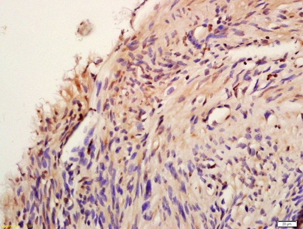 Phospho-AKT1/2/3 (Tyr474) Antibody in Immunohistochemistry (Paraffin) (IHC (P))