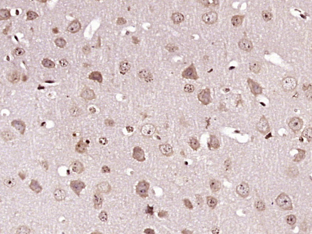Caspase-6 subunit p11 Antibody in Immunohistochemistry (Paraffin) (IHC (P))