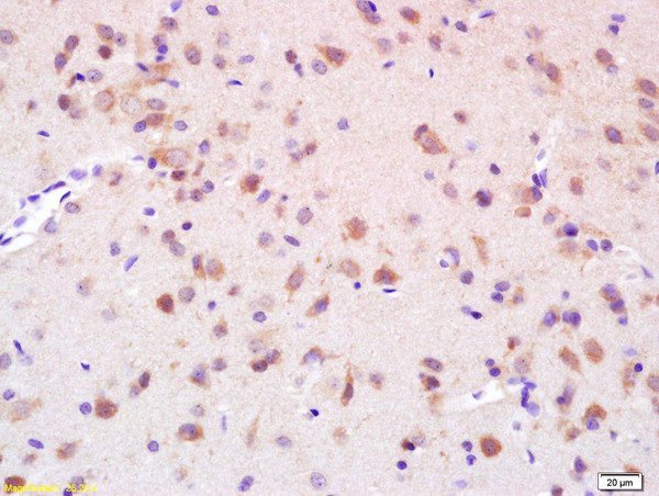 Phospho-Eph receptor B1 (Tyr928) Antibody in Immunohistochemistry (Paraffin) (IHC (P))