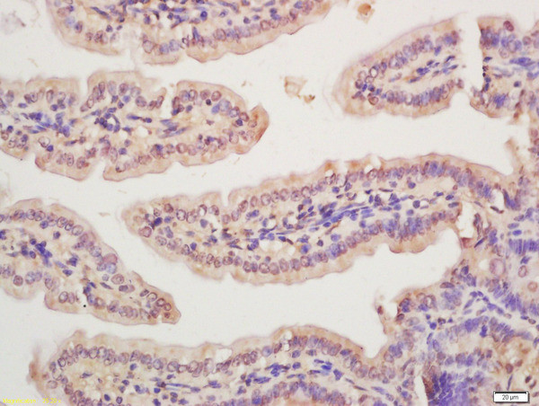Rad51 Antibody in Immunohistochemistry (Paraffin) (IHC (P))
