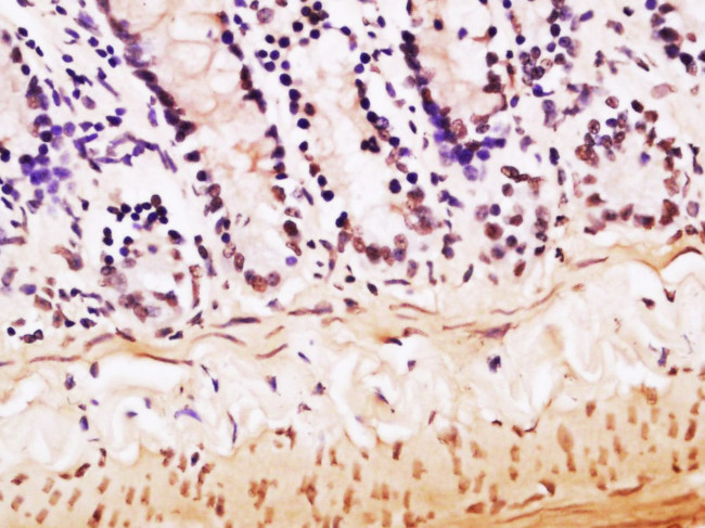 hnRNP M Antibody in Immunohistochemistry (Paraffin) (IHC (P))