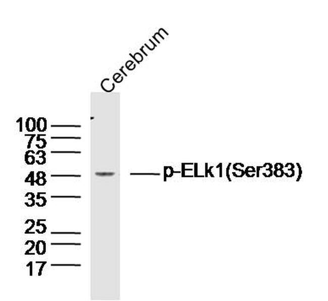 Phospho-ELK1 (Ser383) Antibody in Western Blot (WB)