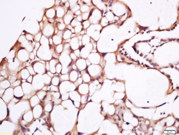 CD274 Antibody in Immunohistochemistry (Paraffin) (IHC (P))
